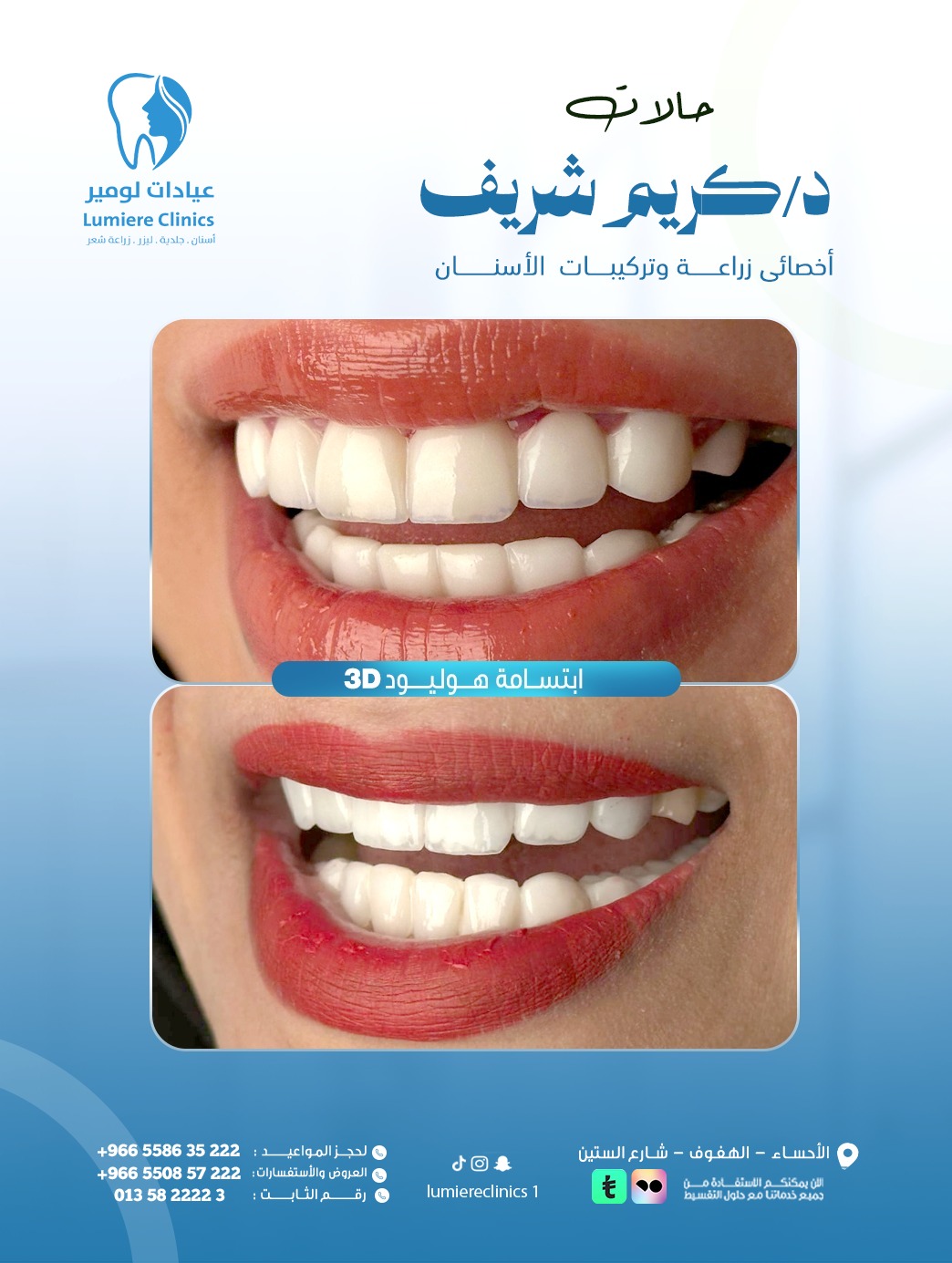 ابتسامة هوليود — حالة مختارة